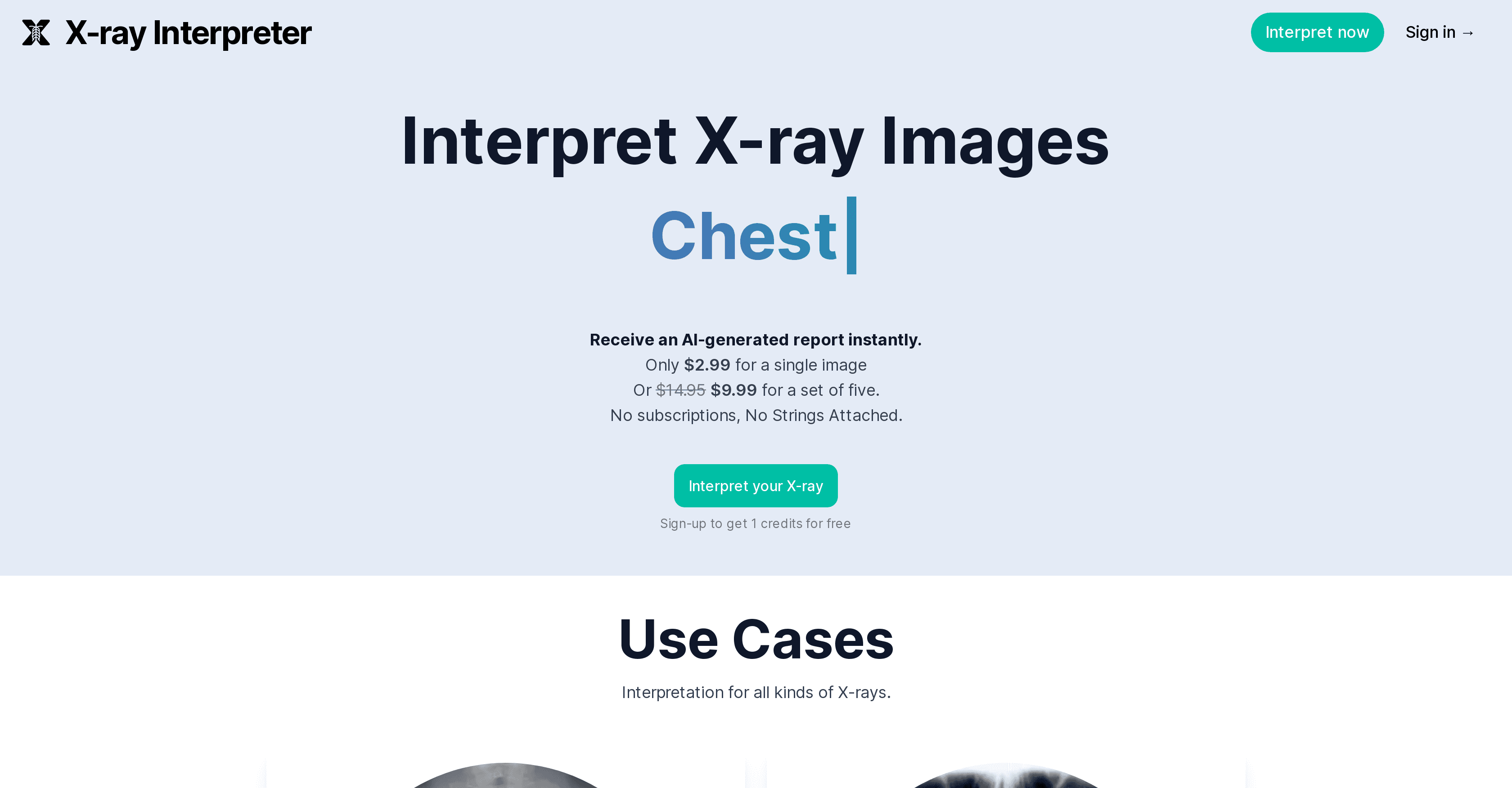 X-ray Interpreter screenshot